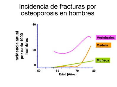 incidencia